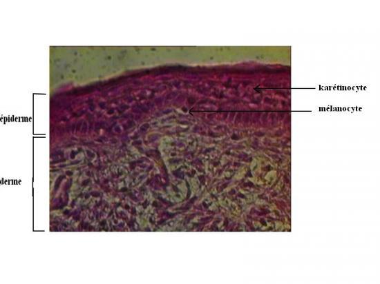 Sur le corps il y avait des taches semblable sur de pigment
