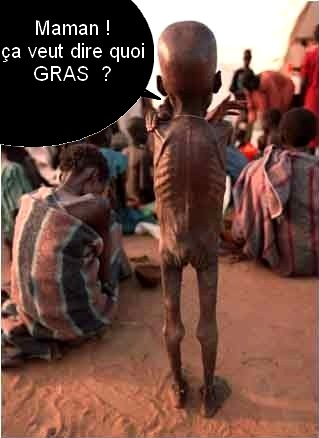 Malnutrition extr&ecirc;me